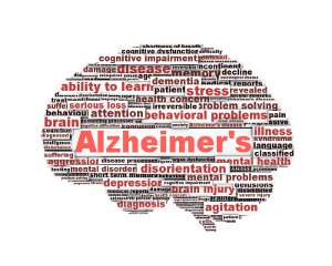 Alzheimer's Brain