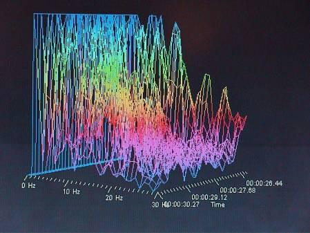 Brain Wave - Toronto Memory Clinic Blog